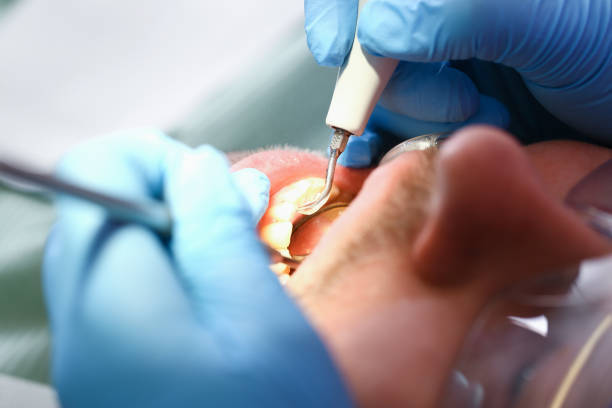 Best Walk-In Emergency Dentist in Bellevue, WA