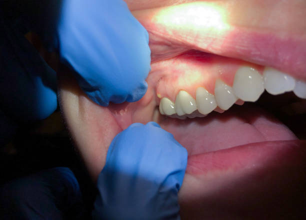 Best Emergency Dental Surgery in Bellevue, WA